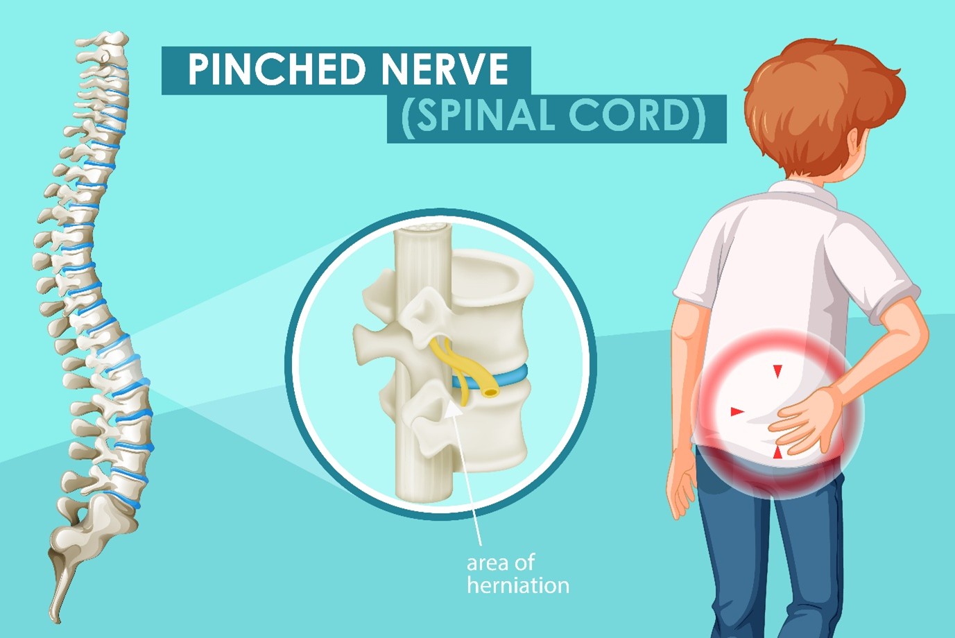 Sciatica and Pinched Nerve Treatment