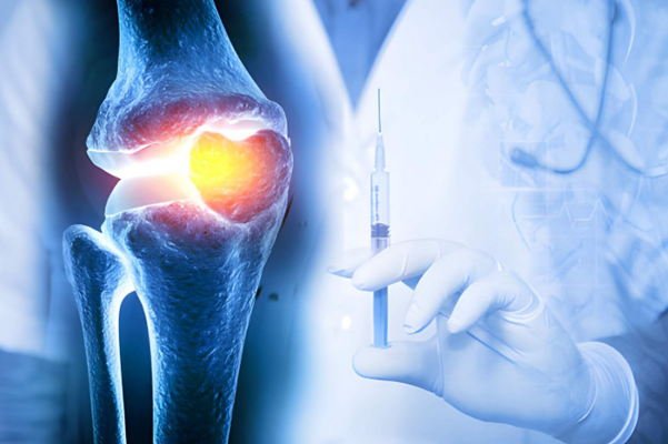 joint injection