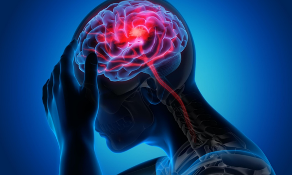 Headache and Migraine