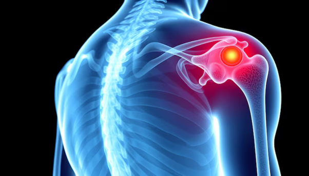 Shoulder Pain Treatment in North Branch