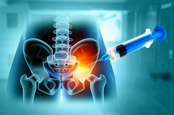 Sacroiliac Joint (SI Joint) Injection 